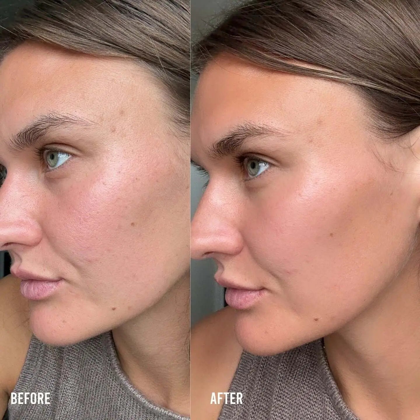 The Rainy Day Face Glow Set Sun Light