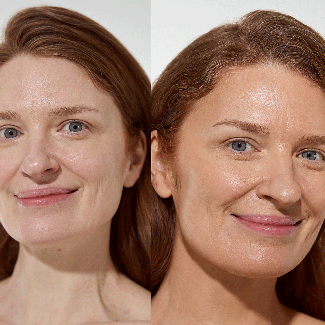 HIGH SUMMER BUNDLE - FACE LIGHT